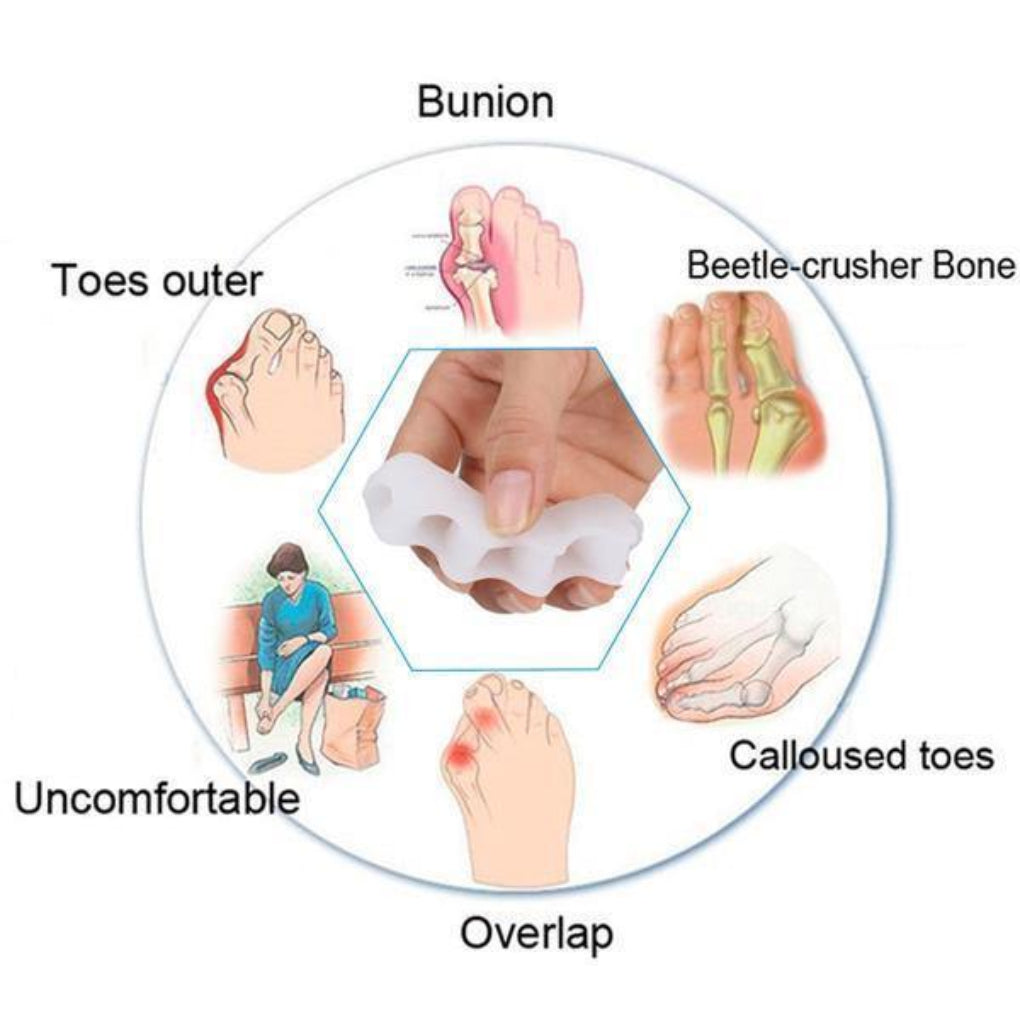 Correcteur orthopédique d'orteils - Séparateur d'orteils