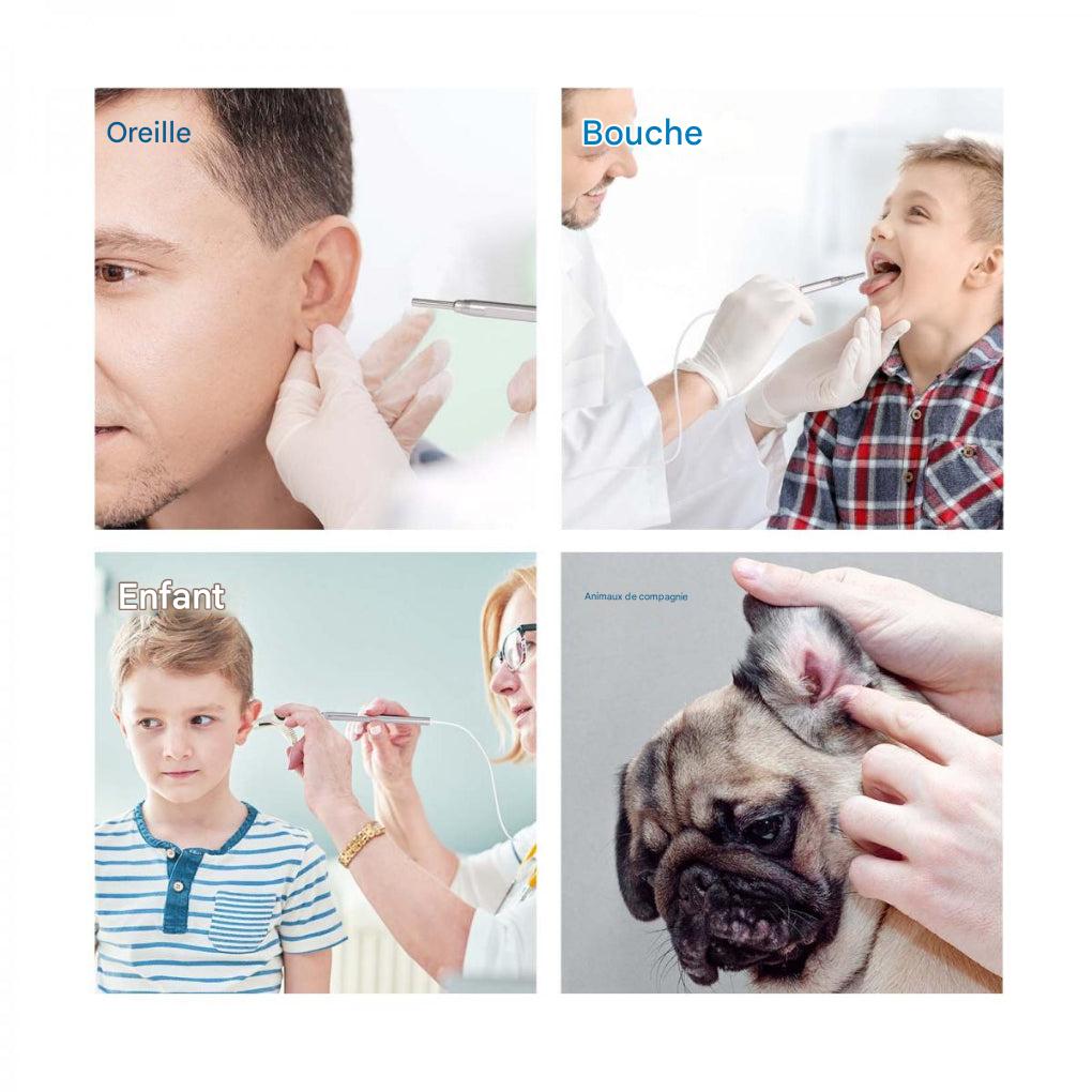 Otoscope numérique avec écran de 4,5 pouces